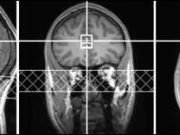 ADHD drugs increase brain glutamate predict positive emotion in healthy people