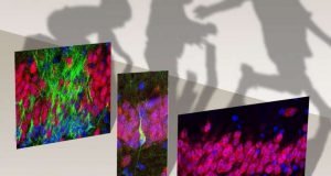 Birth of new neurons in the human hippocampus ends in childhood