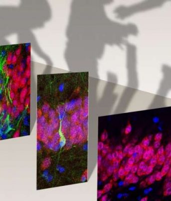 Birth of new neurons in the human hippocampus ends in childhood