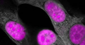 CRISPR genetic editing takes another big step forward targeting RNA