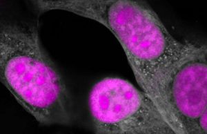CRISPR genetic editing takes another big step forward, targeting RNA CRISPR genetic editing takes another big step forward targeting RNA