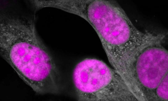 CRISPR genetic editing takes another big step forward targeting RNA CRISPR genetic editing takes another big step forward targeting RNA