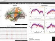 Democratizing science Researchers make neuroscience experiments easier to share reproduce
