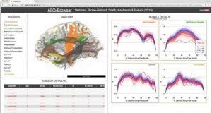 Democratizing science Researchers make neuroscience experiments easier to share reproduce