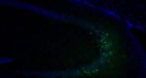 Early life experiences influence DNA in the adult brain