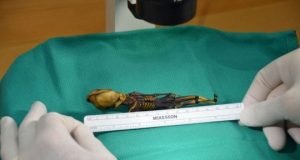 Mysterious skeleton shows molecular complexity of bone diseases