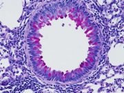 Nervous system puts the brakes on inflammation