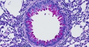 Nervous system puts the brakes on inflammation