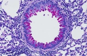 Nervous system puts the brakes on inflammation Nervous system puts the brakes on inflammation