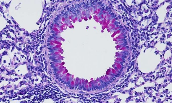 Nervous system puts the brakes on inflammation Nervous system puts the brakes on inflammation