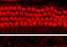 New drugs could help prevent hearing loss