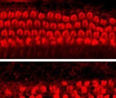New drugs could help prevent hearing loss New drugs could help prevent hearing loss