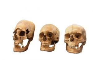 New insights into the origin of elongated heads in early medieval Germany New insights into the origin of elongated heads in early medieval Germany