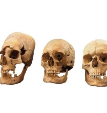 New insights into the origin of elongated heads in early medieval Germany