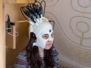 New wearable brain scanner allows patients to move freely for the first time