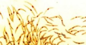 Newly described human antibody prevents malaria in mice