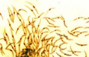 Newly described human antibody prevents malaria in mice Newly described human antibody prevents malaria in mice