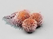 Researchers discover new anti cancer protein