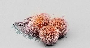 Researchers discover new anti cancer protein