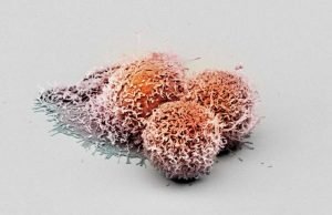 Researchers discover new anti cancer protein