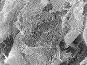 Slow release hydrogel aids immunotherapy for cancer