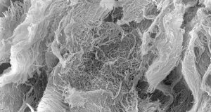 Slow release hydrogel aids immunotherapy for cancer