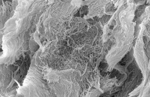 Slow-release hydrogel aids immunotherapy for cancer Slow release hydrogel aids immunotherapy for cancer