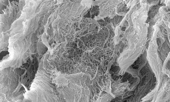 Slow-release hydrogel aids immunotherapy for cancer Slow release hydrogel aids immunotherapy for cancer