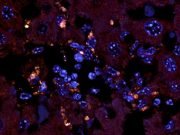 The enemy within Gut bacteria drive autoimmune disease