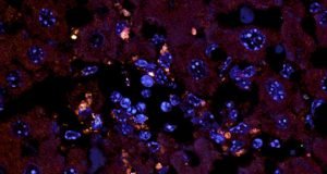 The enemy within Gut bacteria drive autoimmune disease