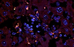 The enemy within: Gut bacteria drive autoimmune disease The enemy within Gut bacteria drive autoimmune disease