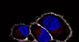 Tiny implants for cells are functional in vivo