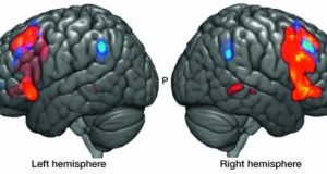 Where language pionieer Paul Broca and alien music meet