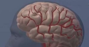Calcium based MRI sensor enables more sensitive brain imaging