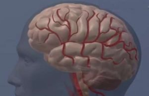 Calcium-based MRI sensor enables more sensitive brain imaging Calcium based MRI sensor enables more sensitive brain imaging