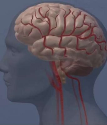 Calcium based MRI sensor enables more sensitive brain imaging