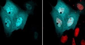 Class of proteins involved in essential cell functions has an unexpected role scientists discover