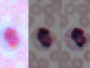 Deep learning transforms smartphone microscopes into laboratory grade devices