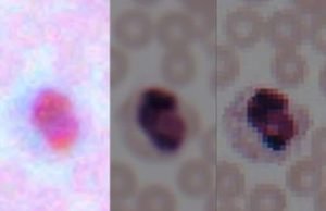 Deep learning transforms smartphone microscopes into laboratory-grade devices Deep learning transforms smartphone microscopes into laboratory grade devices