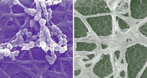 New cellular insights in bone development