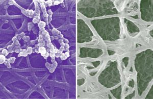 New cellular insights in bone development New cellular insights in bone development
