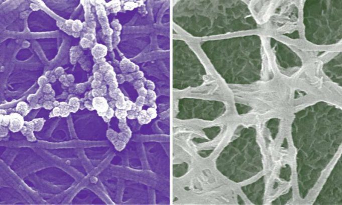 New cellular insights in bone development New cellular insights in bone development