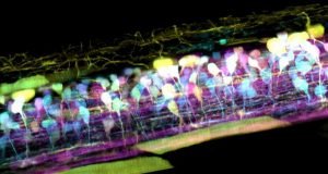 New microscope captures detailed 3 D movies of cells deep within living systems