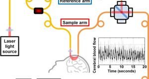New technology for measuring brain blood flow with light
