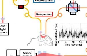 New technology for measuring brain blood flow with light New technology for measuring brain blood flow with light