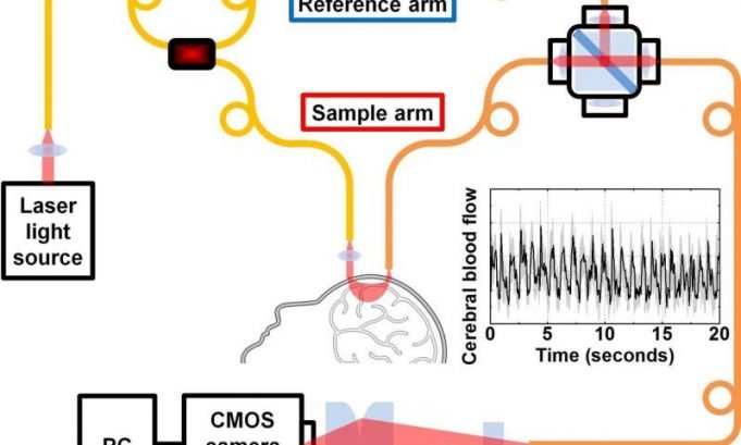 New technology for measuring brain blood flow with light New technology for measuring brain blood flow with light