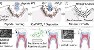 Peptide based biogenic dental product may cure cavities