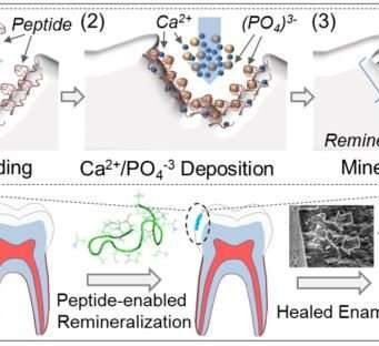 Peptide-based biogenic dental product may cure cavities Peptide based biogenic dental product may cure cavities