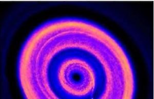 Rings and gaps in a developing planetary system