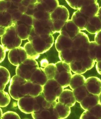 Study reveals how bacteria communicate in groups to avoid antibiotics